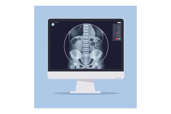 Detailed Medical Illustration of a Spine
